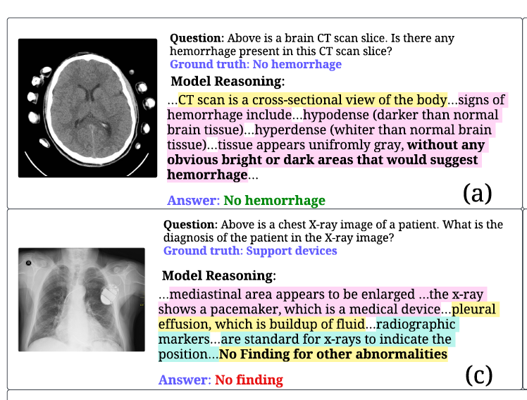 QoQ-Med3: Robust Multimodal Clinical Analysis Foundation Model with Reasoning